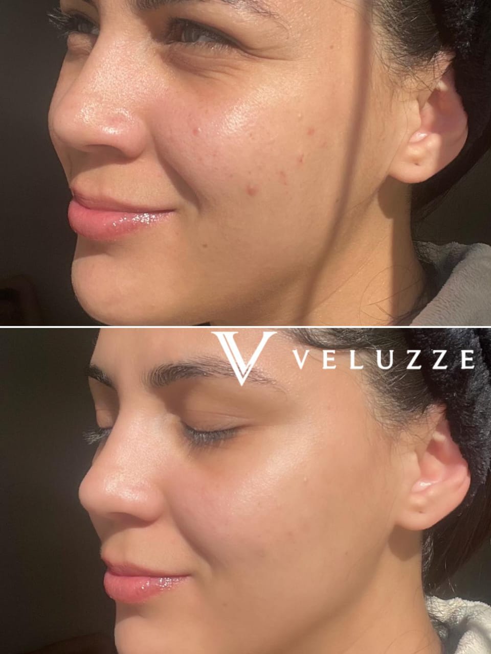 Creme DMAE Rejuvenescedor 40+